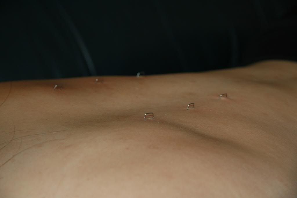 Back 1
